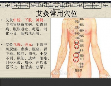 简易辩穴法及其在中医护理操作中的应用