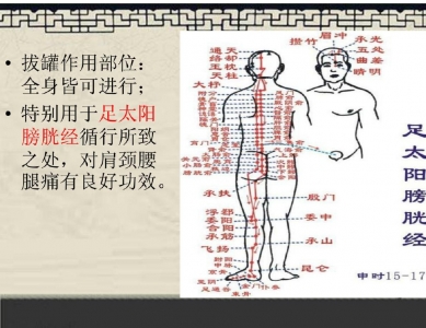 简易辩穴法及其在中医护理操作中的应用