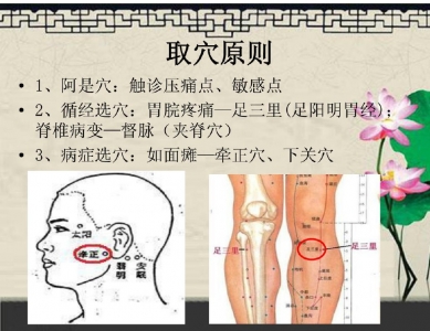 简易辩穴法及其在中医护理操作中的应用