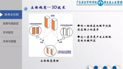 3D胸腔镜下MVR手术配合