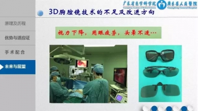 3D胸腔镜下MVR手术配合