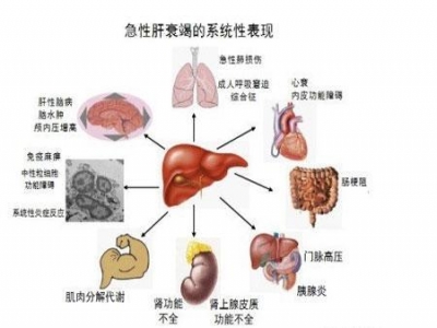 ICU多器官功能障碍综合征的护理