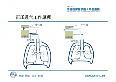 机械通气及护理