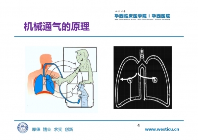 机械通气及护理