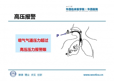 机械通气及护理