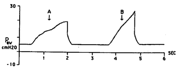 R525iIFtIWoYoX25.jpg