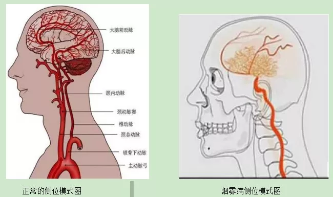 微信图片_20191118172730.png