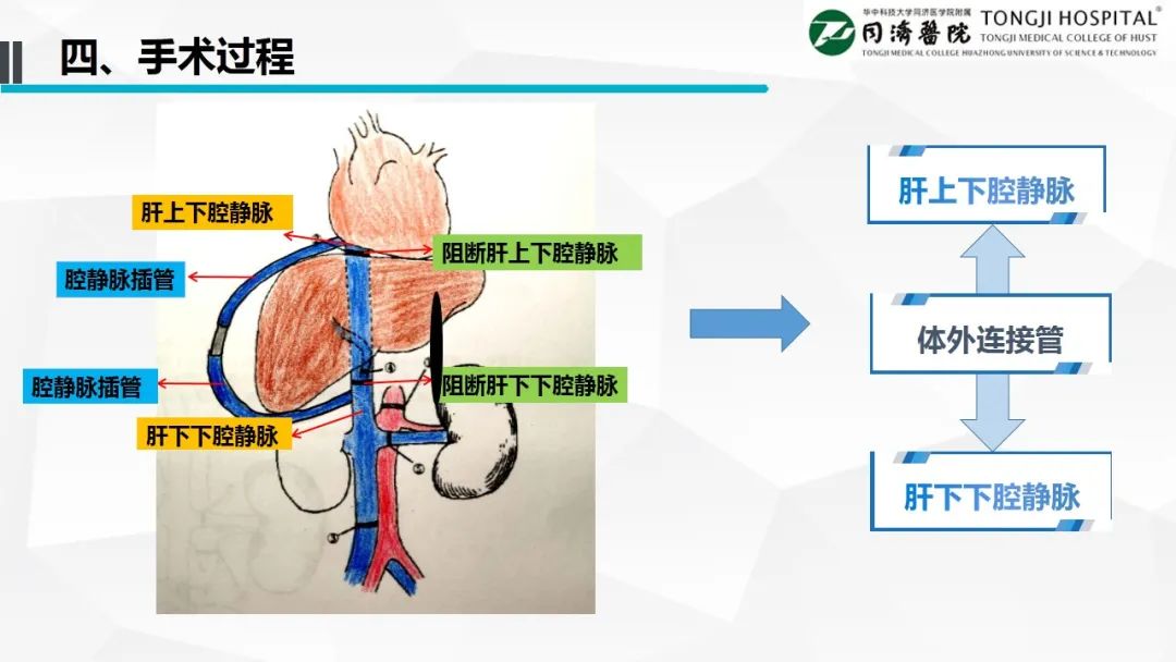 GsD5zdXIu5ICm2Cc.jpg